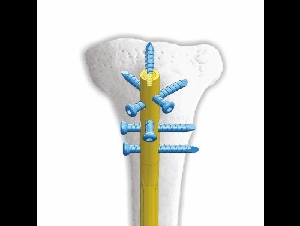 Siora Surgicals Pvt Ltd.